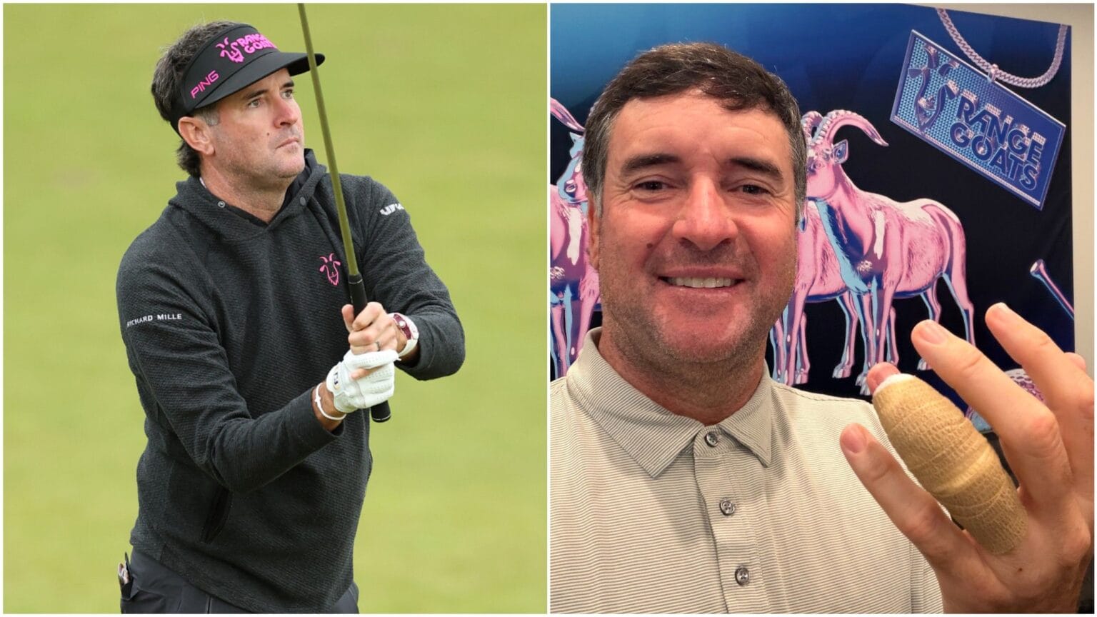 Bubba Watson: Finger Surgery Likely Ends 2025 Season Early